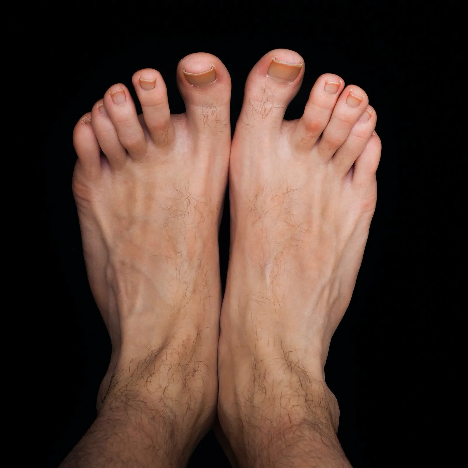 Athletes Foot Plus